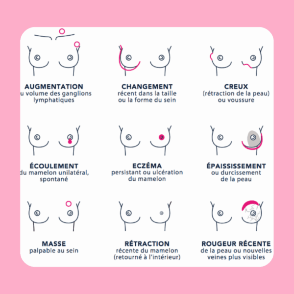 Illustration des principaux symptômes du cancer du sein : augmentation du volume, changement de forme, creux, écoulement du mamelon, eczéma, épaississement, masse palpable, rétraction du mamelon, rougeur récente.
